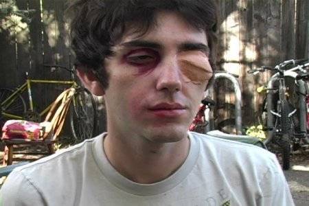 Young man wearing makeup that makes him look beat-up with a swollen eye.