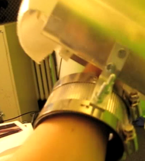 A person has one of their limbs in a metal ring.